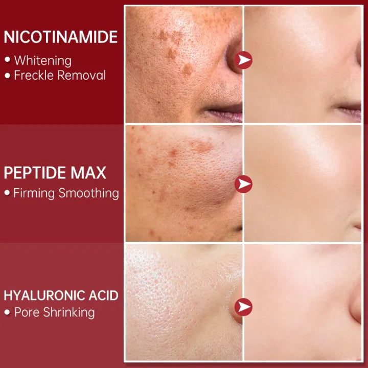 FORT PORE REFINING SERUM